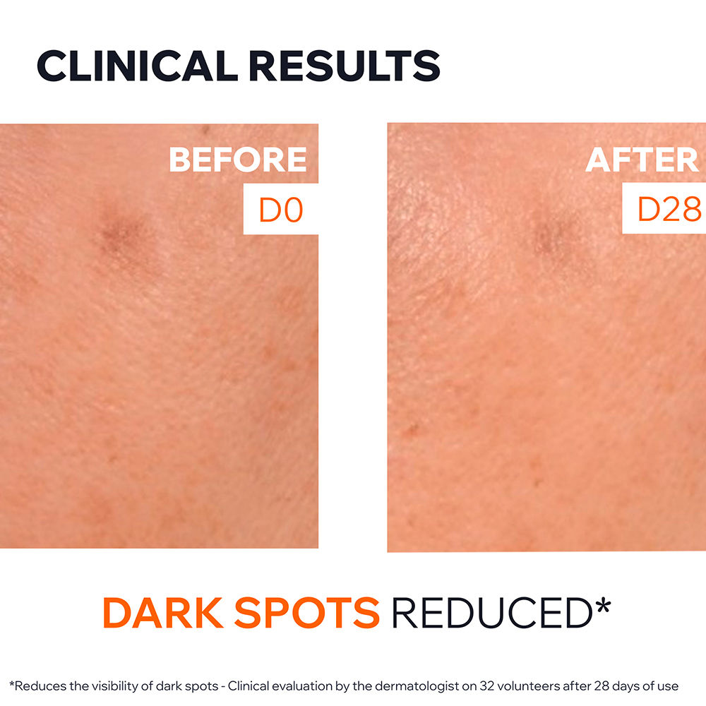 DEPIDERM Serum anti-spot solution with 20% vitamin C and niacinamide 30 ml view 5