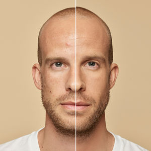 ACCORD PARFAIT foundation hyaluronic acid