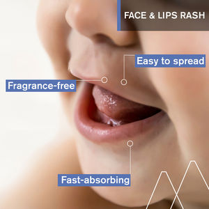 1ER cuidado peri-oral