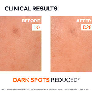 DEPIDERM Soro solução anti-manchas com 20% de vitamina C e niacinamida