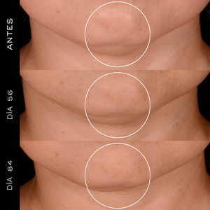 RÉNERGIE HPN 300 krem regenerujący z peptydami