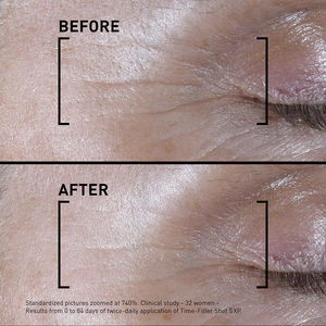 TIME-FILLER SHOT 5XP concentrated serum for correcting visible expression lines