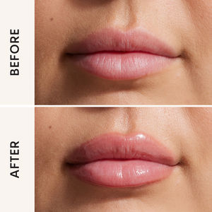 LIP FILLER volumizing lip gloss