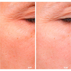 siero avanzato VIT-C al 25%