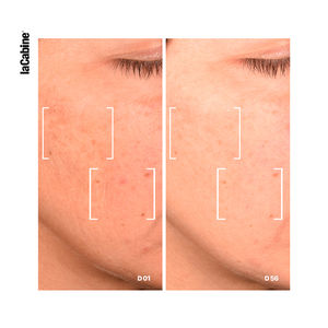 25% NIACINAMIDE PRO COMPLEX uzlabots serums