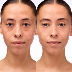 INSTANT BRIGHT corrective serum
