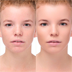 INSTANT BRIGHT corrective serum