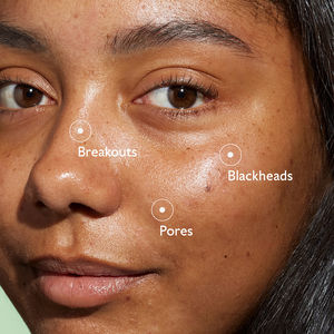 VINOPURE anti-blemish serum