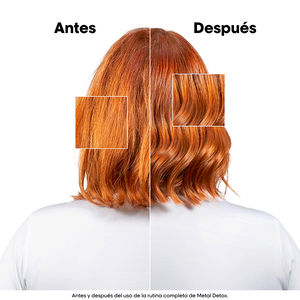 METALOWE OBUDOWA DETOKSYKACYJNA