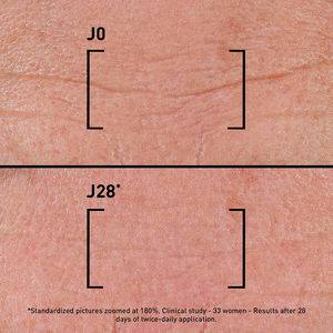 TIME-FILLER INTENSIVE 5XP correcting serum-all types of wrinkles