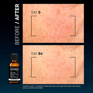 DAILY PEEL – atnaujinamasis sprendimas nuo spuogų