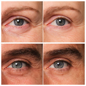 ABEILLE ROYALE rejuvenating and repairing eye treatment