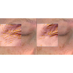 Maschere per il contorno occhi al collagene PEPTIDE PLUMP