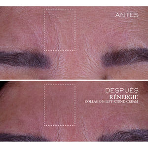 RÉNERGIE COLLAGEN+ Krem LIFT-XTEND