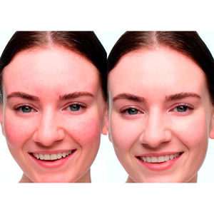 CICAPAIR gotas calmantes de color SPF20