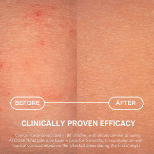 ATODERM INTENSIVE facial cream for atopic skin