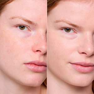 Porenverfeinerndes Serum-Primer