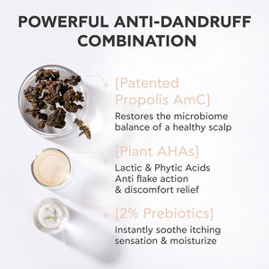 DANDRUFF RELIEF dermatological scalp lotion with immediate calming effect